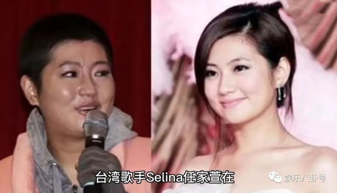 selina九年前談及燒傷復(fù)健歷程看哭了,，selina眼眶中都是淚水