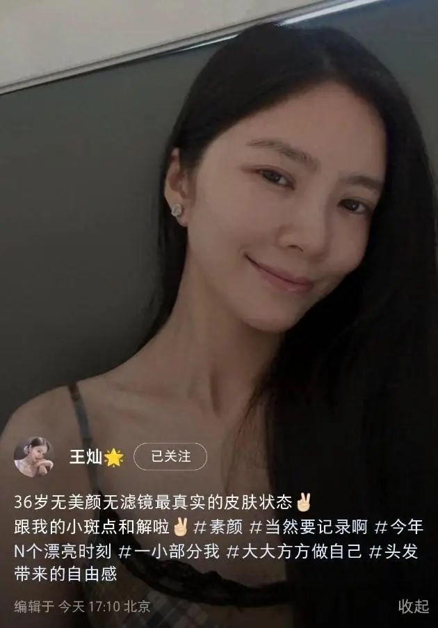  杜淳36歲嬌妻自信曬全素顏,，臉上斑點明顯,，但皮膚緊致看不到皺紋